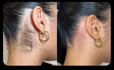 Neck Result