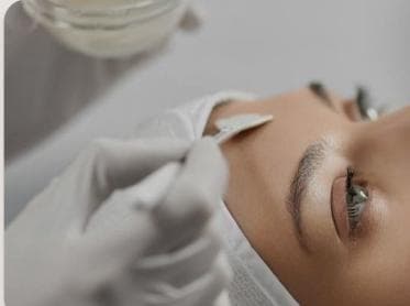 Chemical Peels (VI Peel)