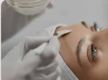 Chemical Peels (VI Peel)