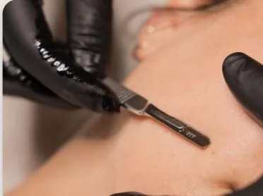 Dermaplane