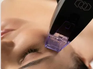 Morpheus8 RF Microneedling