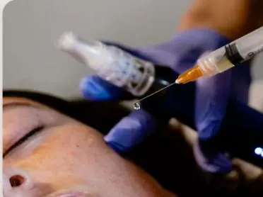 PRF Gel Facial