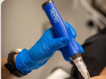 SkinPen Microneedling