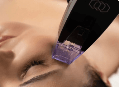 Advanced RF & Microneedling
