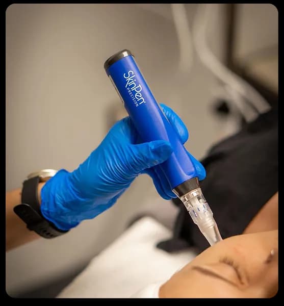 SkinPen Microneedling Treatment