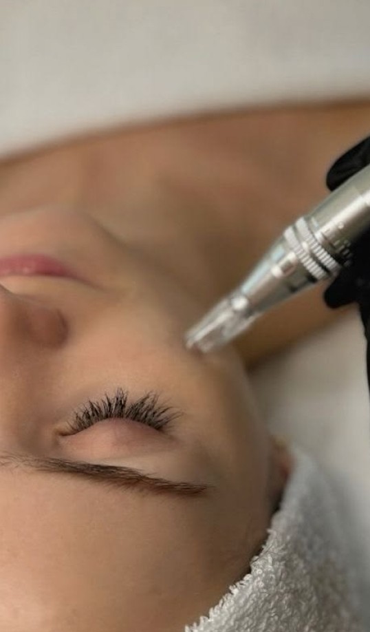 How SkinPen microneedling works at Elevate Aesthetics