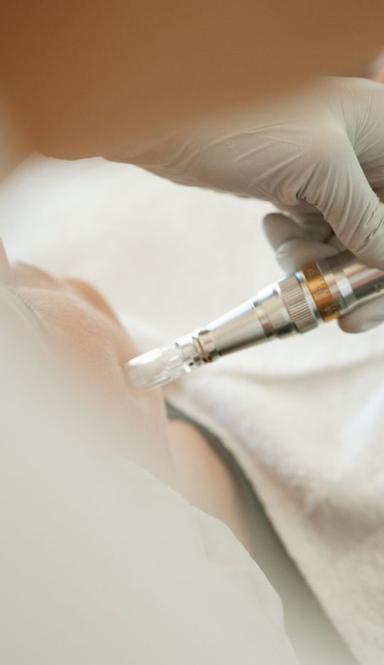 What is microneedling at Elevate Aesthetics Glendale