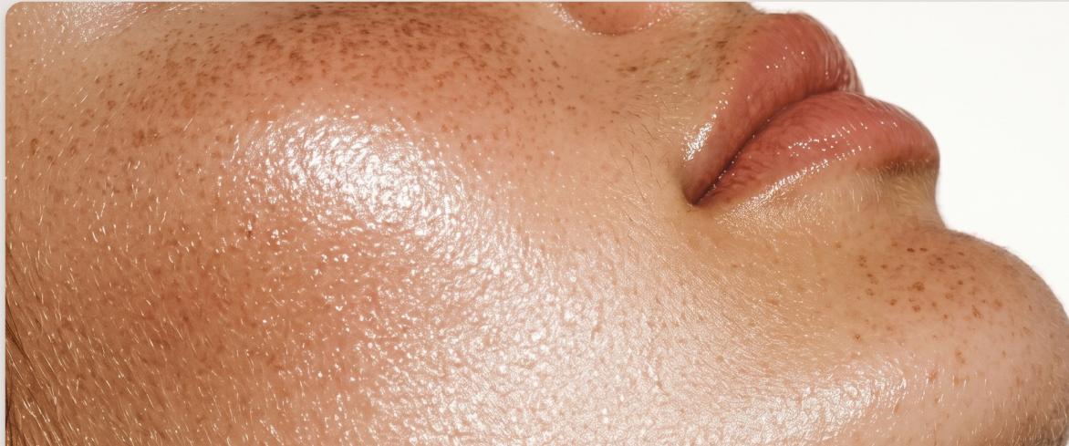 Book your skin rejuvenation consultation at Elevate Aesthetics