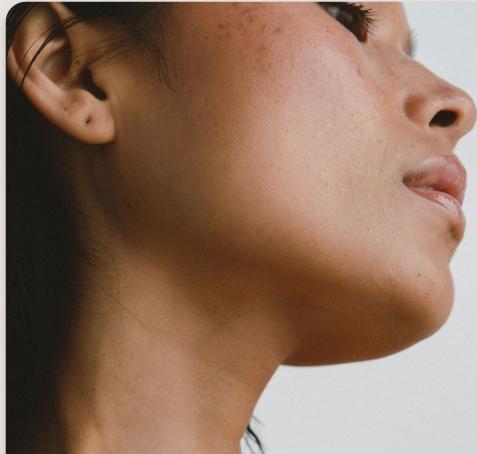 Skin rejuvenation pricing at Elevate Aesthetics Glendale