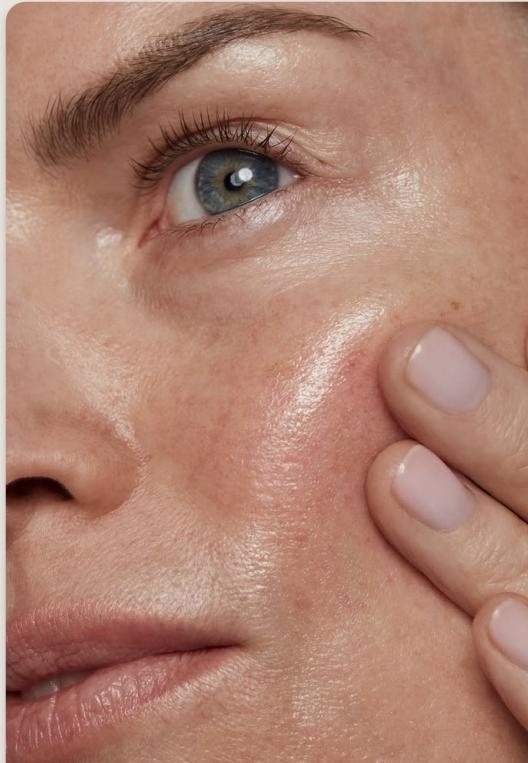What is Skin Rejuvenation at Elevate Aesthetics Glendale